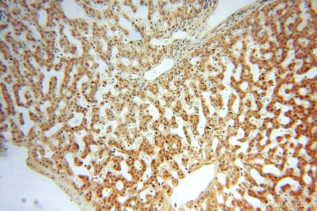 Immunohistochemistry (IHC) staining of human liver tissue using ATP5F1 Polyclonal antibody (15999-1-AP)