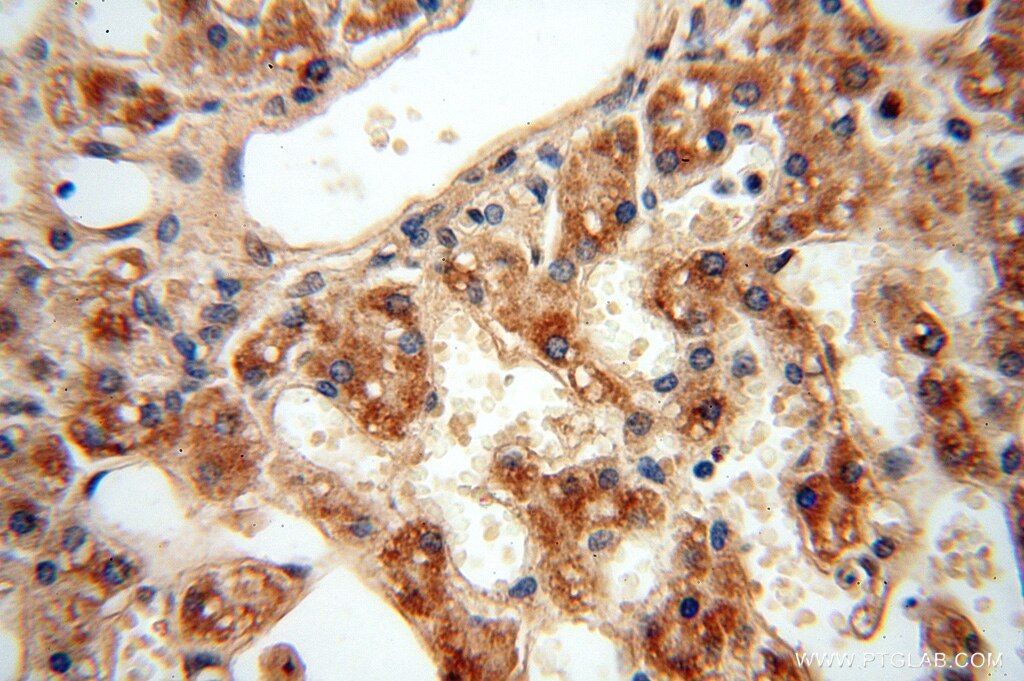 Immunohistochemistry (IHC) staining of human liver tissue using ATP5F1 Polyclonal antibody (15999-1-AP)