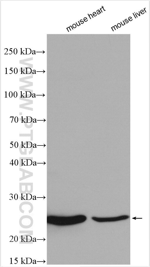 Western Blot (WB) analysis of various lysates using ATP5F1 Polyclonal antibody (15999-1-AP)