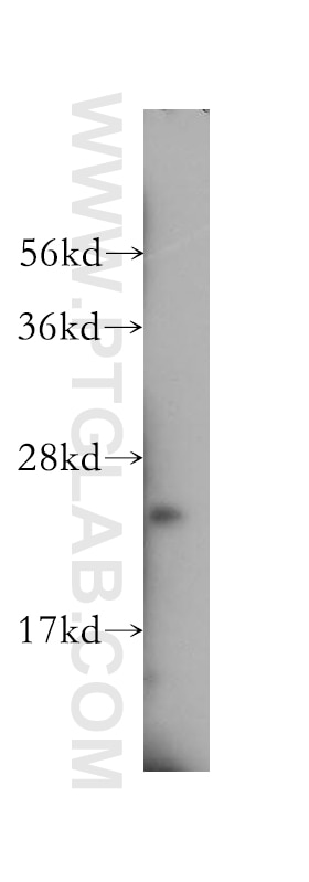 Western Blot (WB) analysis of mouse skeletal muscle tissue using ATP5F1 Polyclonal antibody (15999-1-AP)