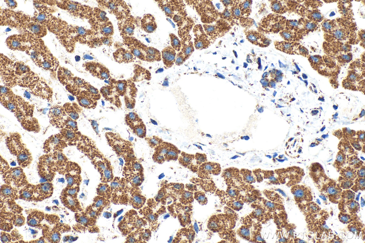 Immunohistochemistry (IHC) staining of human liver tissue using ATP5F1 Monoclonal antibody (68304-1-Ig)