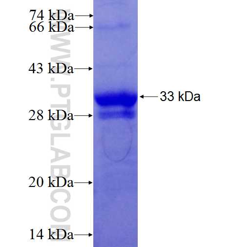 ATP5F1 fusion protein Ag8571 SDS-PAGE
