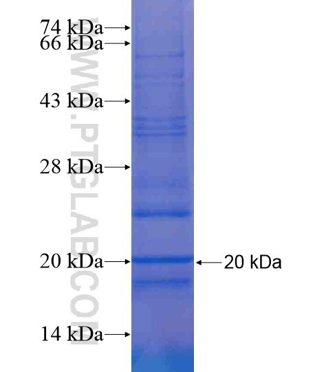 ATP5G1 fusion protein Ag20933 SDS-PAGE ATP5G1 fusion protein Ag20933 SDS-PAGE