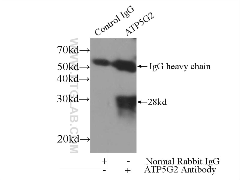 Immunoprecipitation (IP) experiment of HEK-293 cells using ATP5G2-Specific Polyclonal antibody (19785-1-AP)