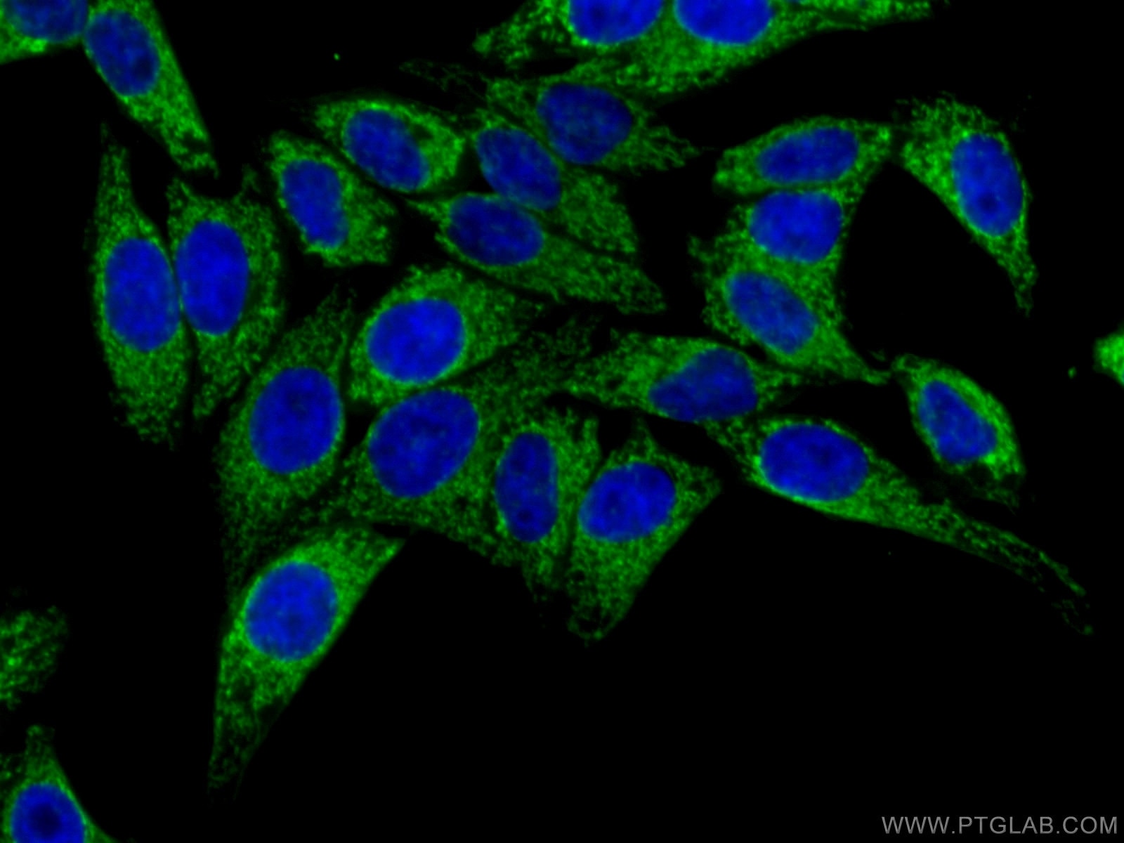 Immunofluorescence (IF) / fluorescent staining of HepG2 cells using ATP5H Polyclonal antibody (17589-1-AP)