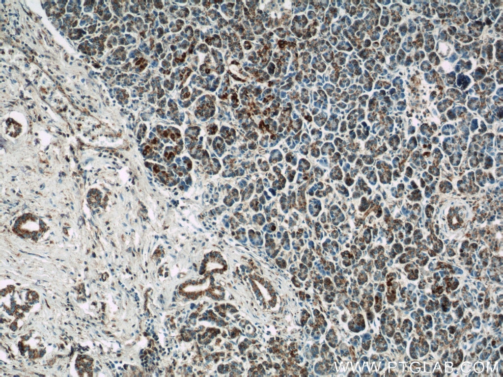 Immunohistochemistry (IHC) staining of human pancreas tissue using ATP5H Polyclonal antibody (17589-1-AP)