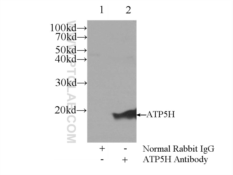 Immunoprecipitation (IP) experiment of mouse liver tissue using ATP5H Polyclonal antibody (17589-1-AP)