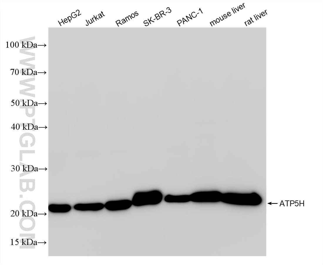 ATP5H