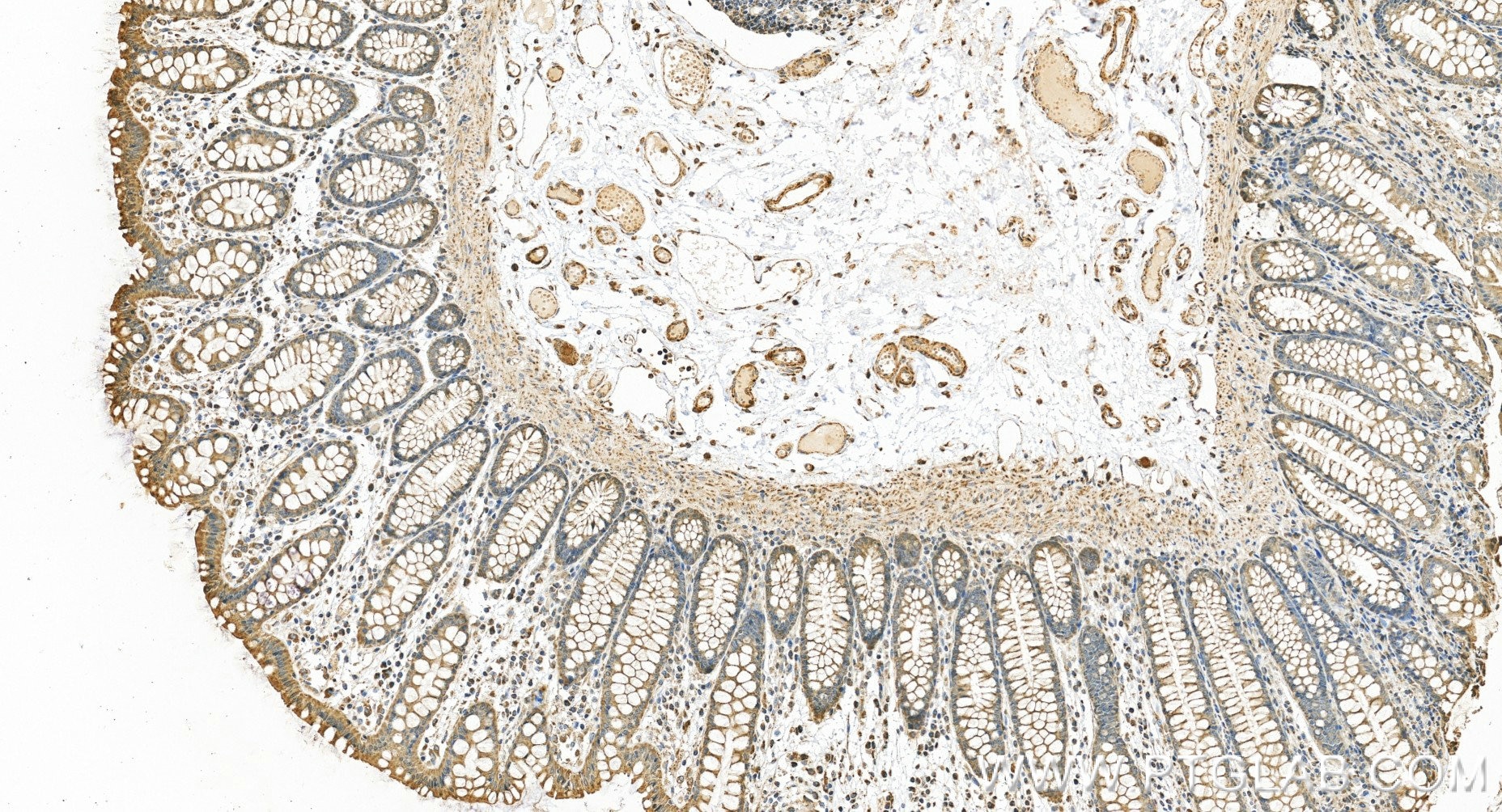 Immunohistochemistry (IHC) staining of human colon tissue using ATP5I Recombinant monoclonal antibody (86218-2-RR)