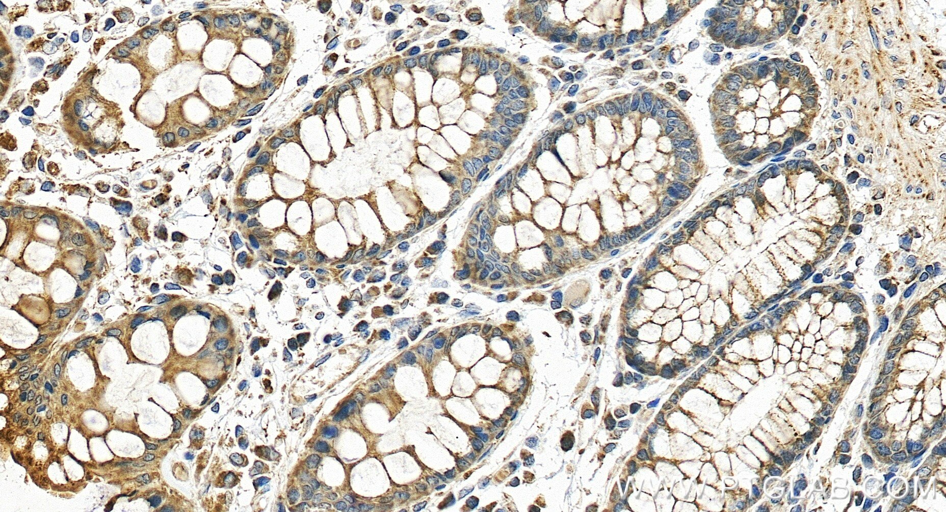 Immunohistochemistry (IHC) staining of human colon tissue using ATP5I Recombinant monoclonal antibody (86218-2-RR)