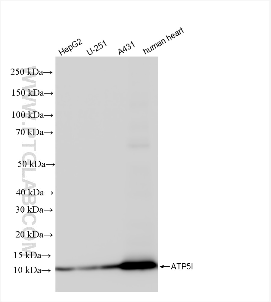 Western Blot (WB) analysis of various lysates using ATP5I Recombinant antibody (86218-2-RR)