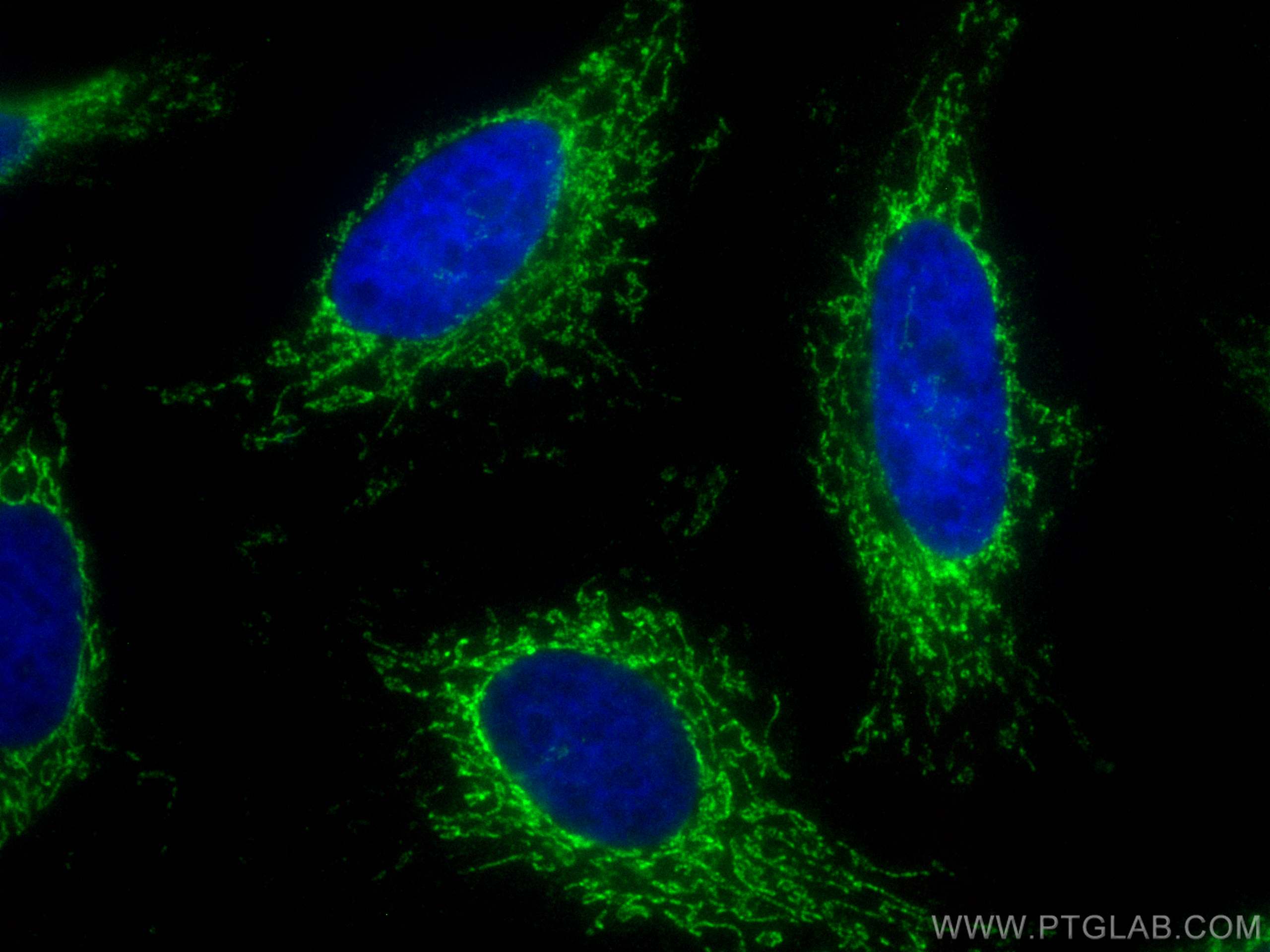 Immunofluorescence (IF) / fluorescent staining of HeLa cells using CoraLite® Plus 488-conjugated ATP5I Polyclonal ant (CL488-16483)