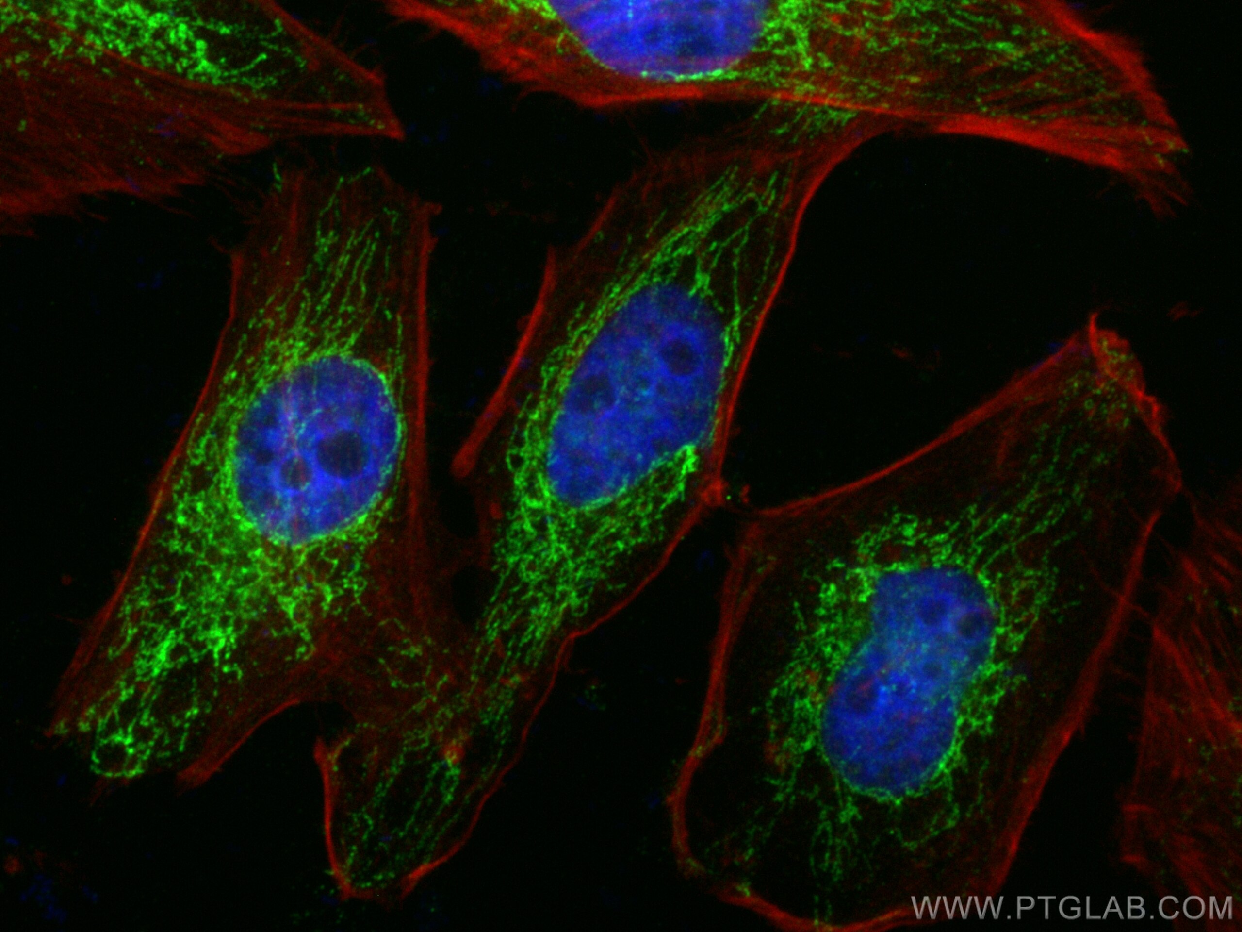 Immunofluorescence (IF) / fluorescent staining of HeLa cells using ATP5J Polyclonal antibody (14114-1-AP)