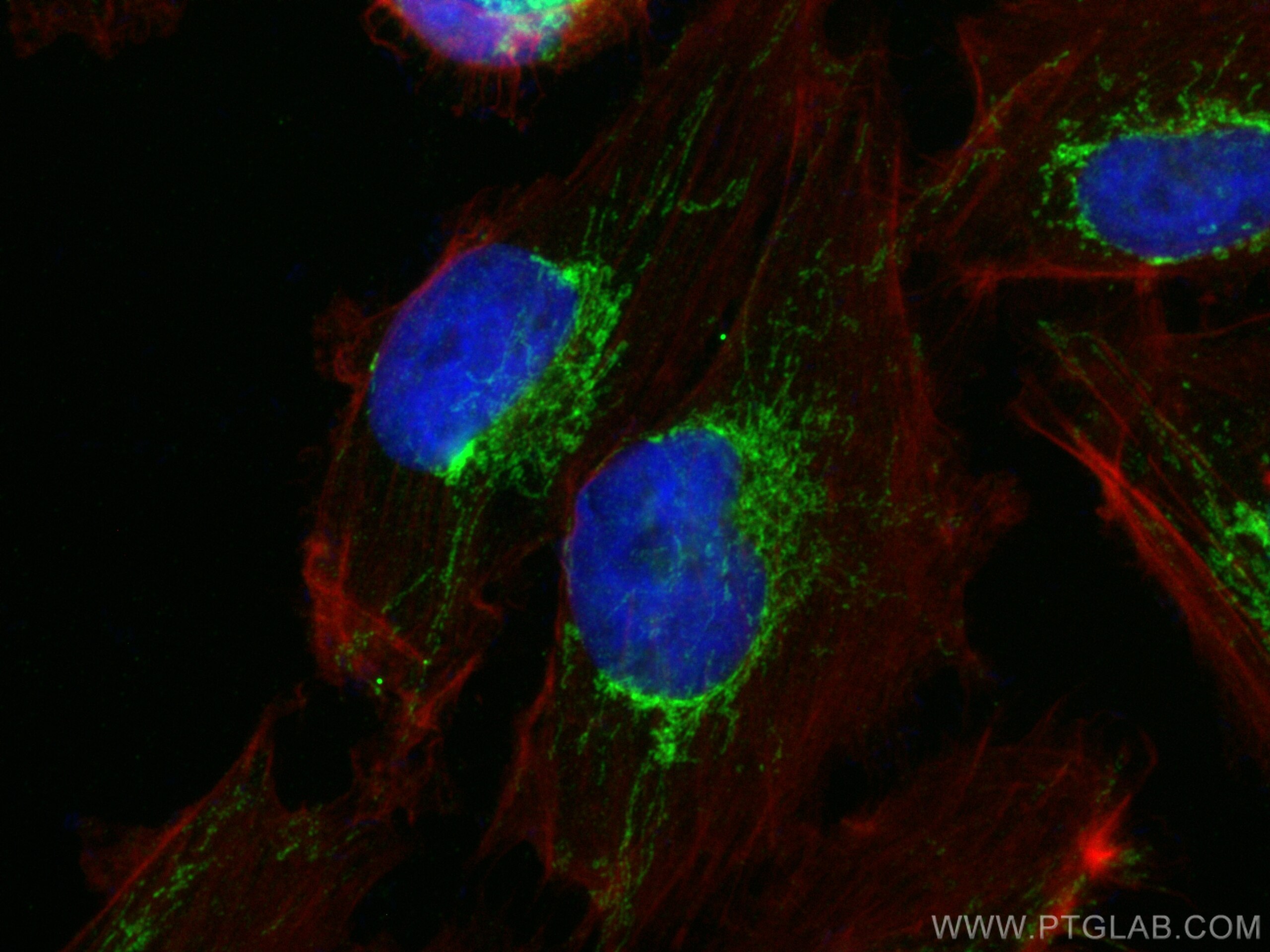 Immunofluorescence (IF) / fluorescent staining of U-251 cells using ATP5J Polyclonal antibody (14114-1-AP)
