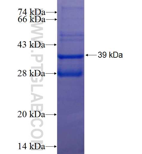 ATP5J fusion protein Ag5263 SDS-PAGE