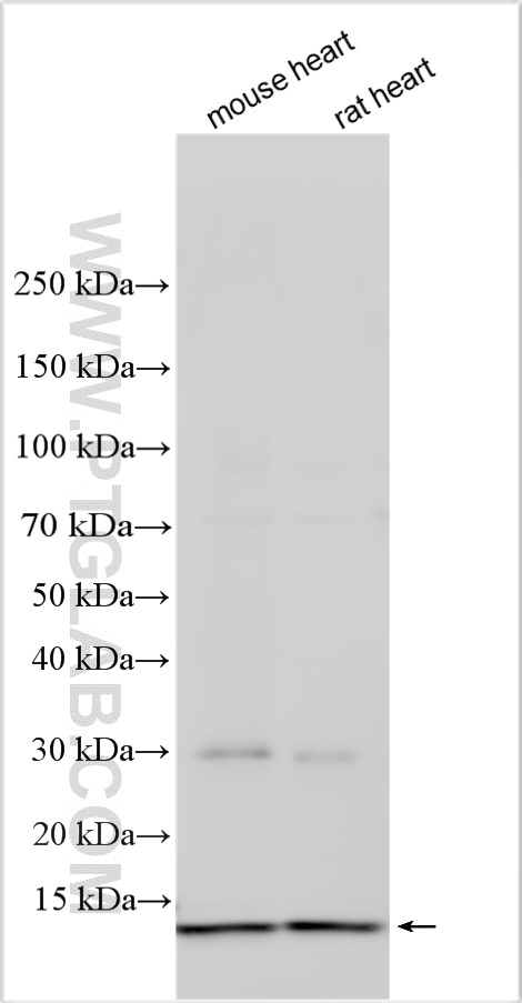 Western Blot (WB) analysis of various lysates using ATP5J2 Polyclonal antibody (15842-1-AP)