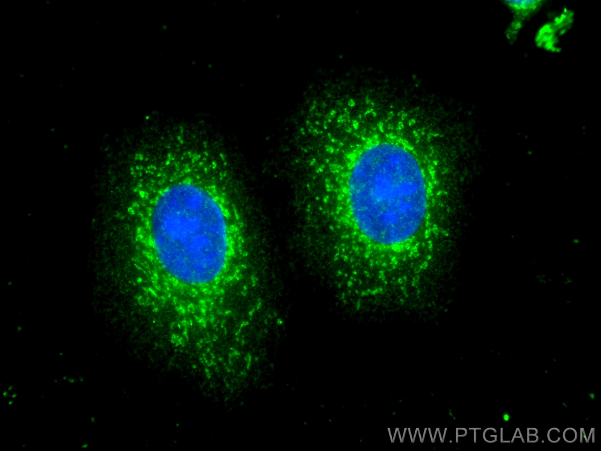 Immunofluorescence (IF) / fluorescent staining of MCF-7 cells using ATP5J2 Monoclonal antibody (68128-1-Ig)
