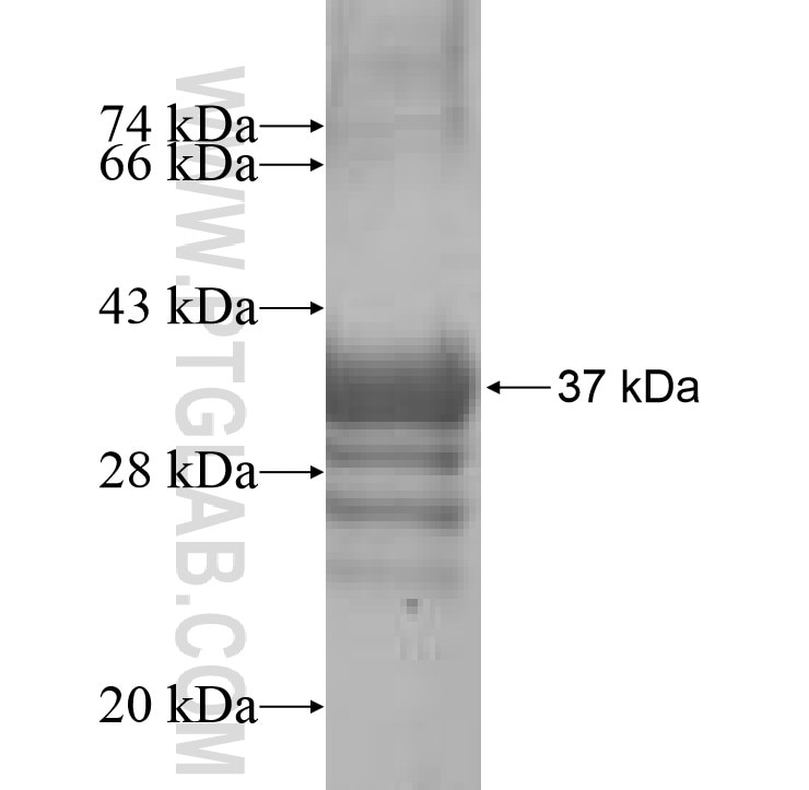 ATP5J2 fusion protein Ag8598 SDS-PAGE