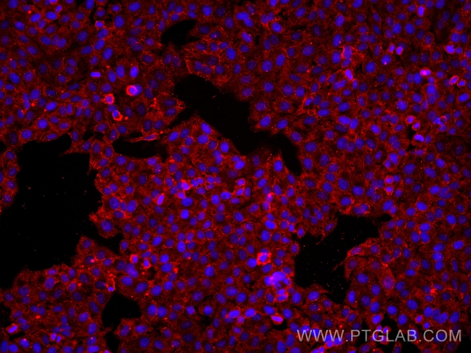 ATP5L