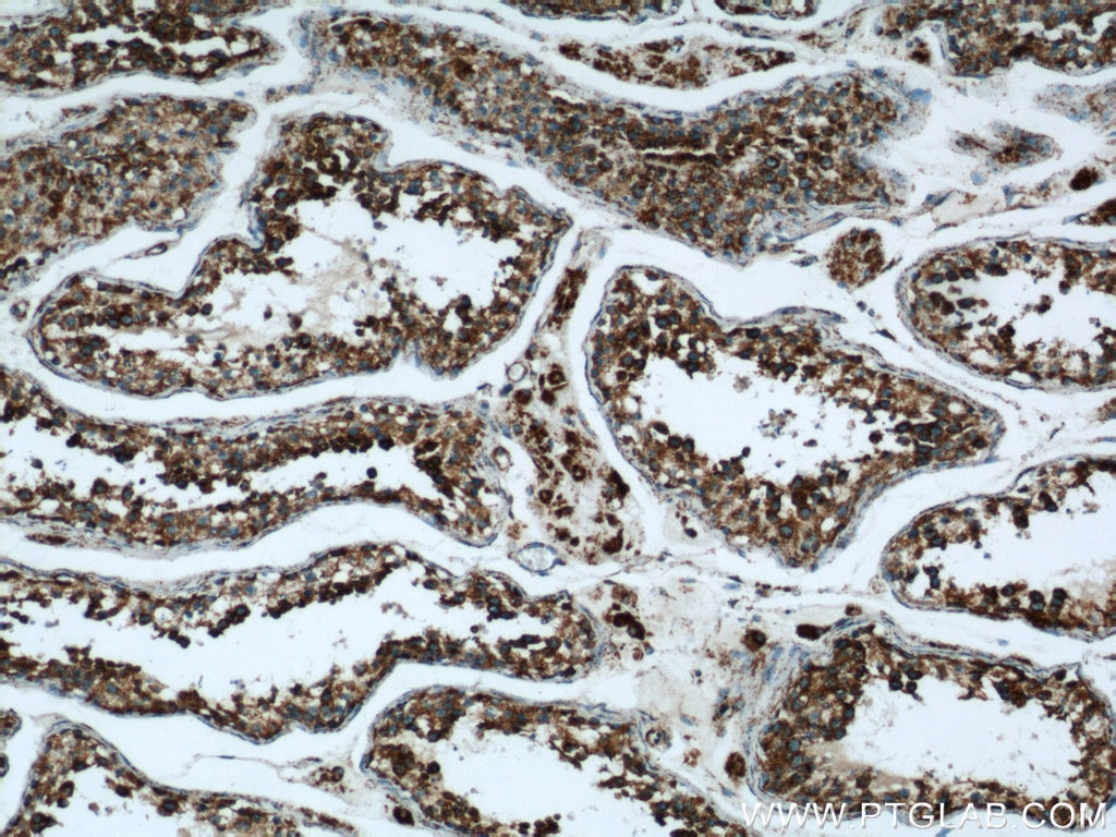 Immunohistochemistry (IHC) staining of human testis tissue using ATP5O Polyclonal antibody (10994-1-AP)