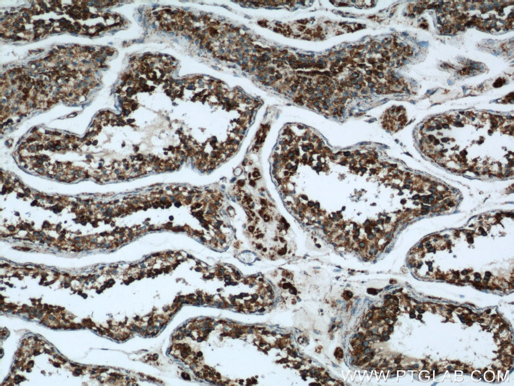 IHC staining of human testis using 10994-1-AP