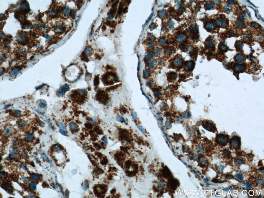 IHC staining of human testis using 10994-1-AP