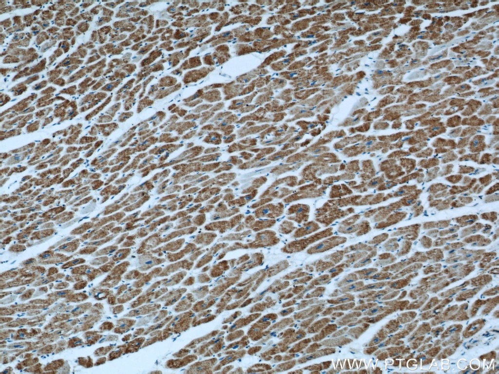 Immunohistochemistry (IHC) staining of human heart tissue using ATP5O Polyclonal antibody (10994-1-AP)