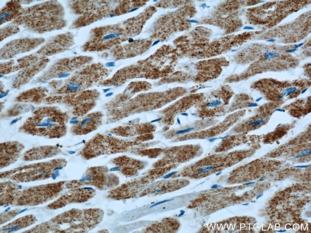 Immunohistochemistry (IHC) staining of human heart tissue using ATP5O Polyclonal antibody (10994-1-AP)