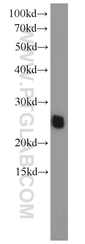 WB analysis of mouse heart using 10994-1-AP