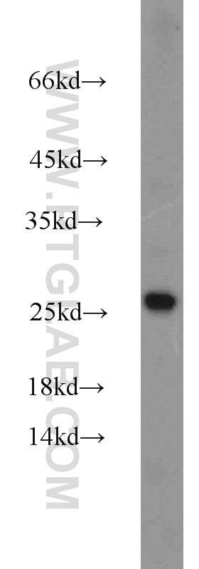 Western Blot (WB) analysis of mouse colon tissue using ATP5O Polyclonal antibody (10994-1-AP)