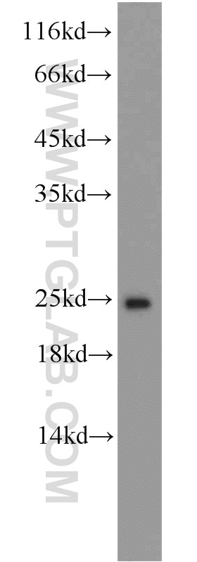 Western Blot (WB) analysis of mouse placenta tissue using ATP5O Polyclonal antibody (10994-1-AP)