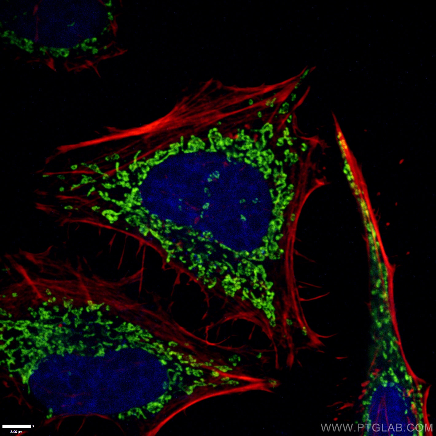 Immunofluorescence (IF) / fluorescent staining of HeLa cells using ATP5O Monoclonal antibody (66696-1-Ig)