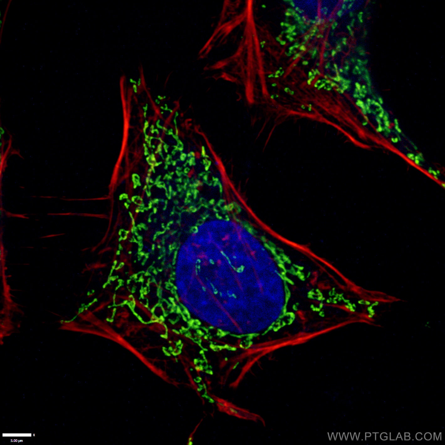 Immunofluorescence (IF) / fluorescent staining of HeLa cells using ATP5O Monoclonal antibody (66696-1-Ig)