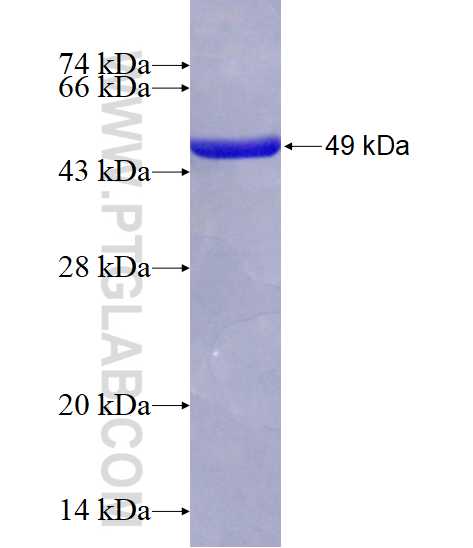 ATP5O fusion protein Ag1458 SDS-PAGE