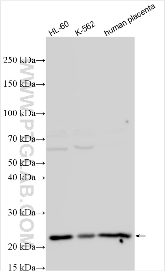 Western Blot (WB) analysis of various lysates using ATP5S Polyclonal antibody (16335-1-AP)