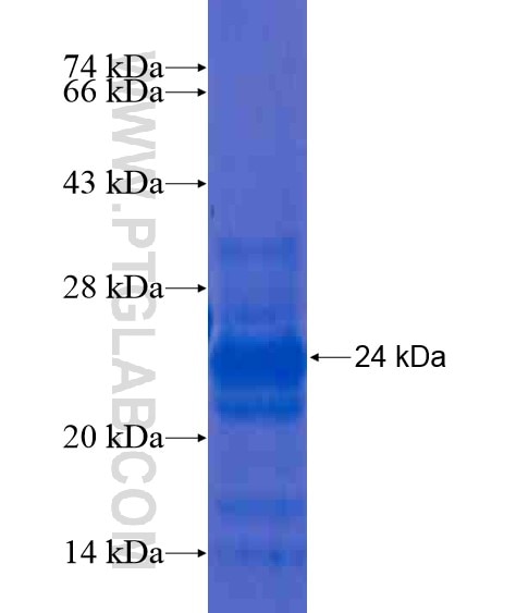 ATP5SL fusion protein Ag20909 SDS-PAGE