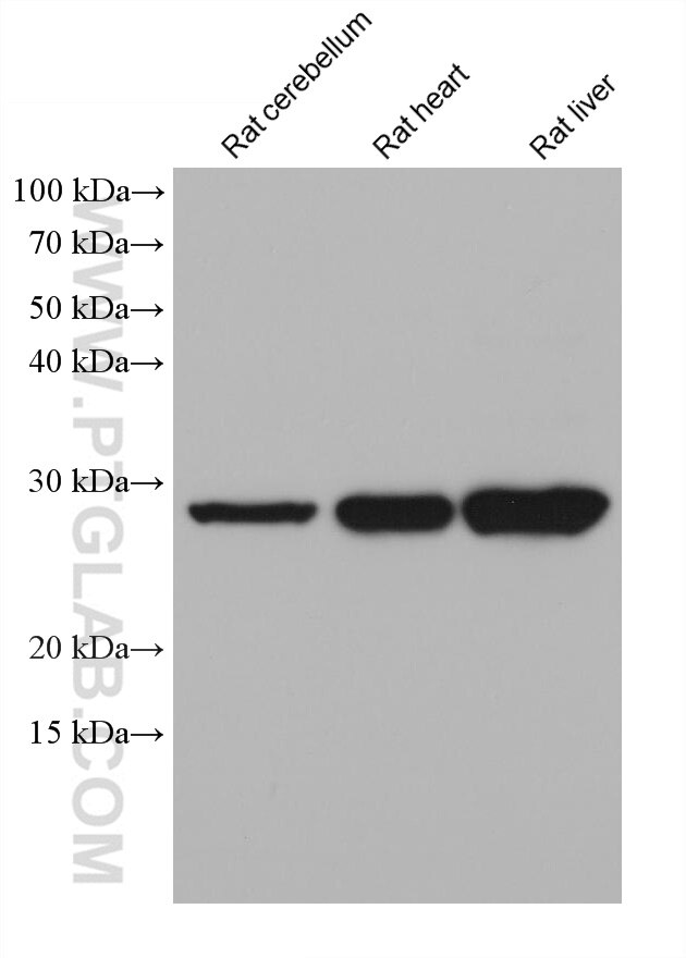 Western Blot (WB) analysis of various lysates using ATP6 Monoclonal antibody (68442-1-Ig)