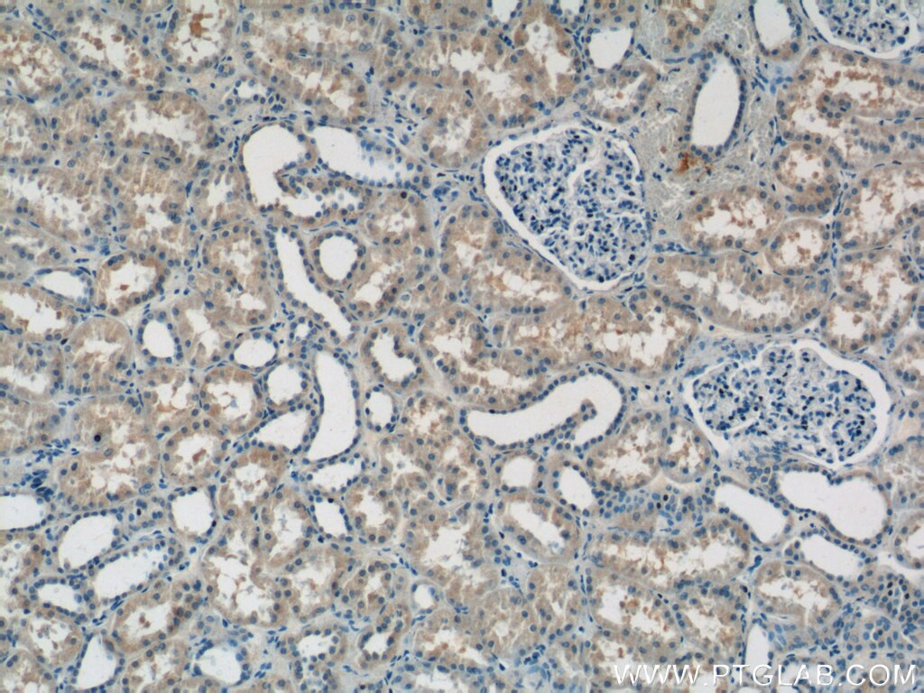 Immunohistochemistry (IHC) staining of human kidney tissue using ATP6AP1 Polyclonal antibody (15305-1-AP)