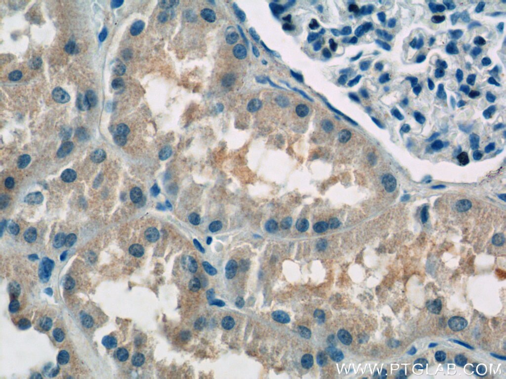 Immunohistochemistry (IHC) staining of human kidney tissue using ATP6AP1 Polyclonal antibody (15305-1-AP)