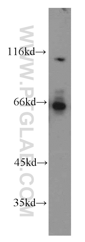 Western Blot (WB) analysis of HeLa cells using ATP6AP1 Polyclonal antibody (15305-1-AP)