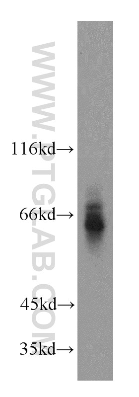 Western Blot (WB) analysis of mouse kidney tissue using ATP6AP1 Polyclonal antibody (15305-1-AP)
