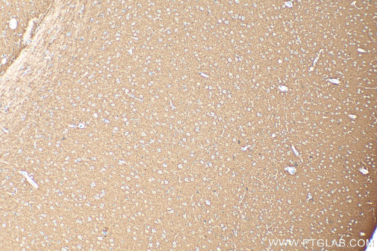 Immunohistochemistry (IHC) staining of mouse brain tissue using ATP6V0A1 Polyclonal antibody (13828-1-AP)