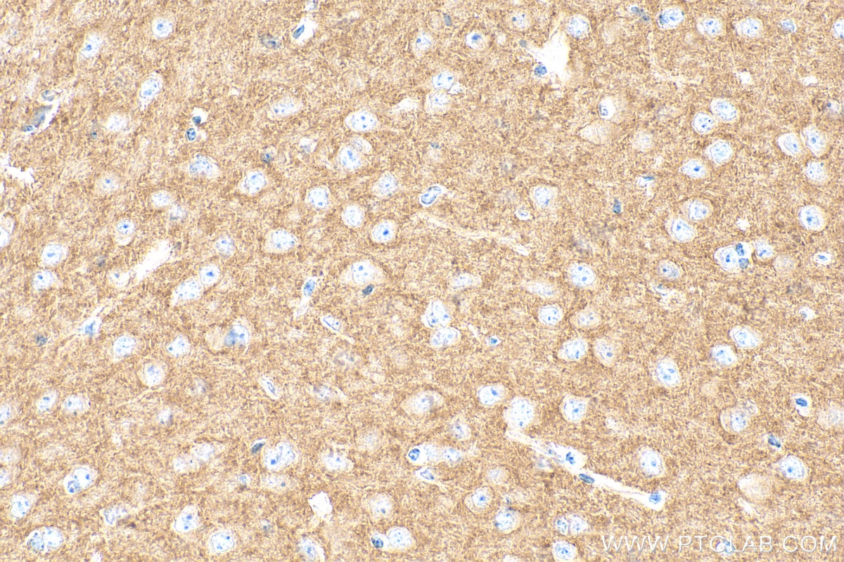 Immunohistochemistry (IHC) staining of mouse brain tissue using ATP6V0A1 Polyclonal antibody (13828-1-AP)