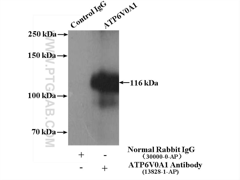 Immunoprecipitation (IP) experiment of mouse brain tissue using ATP6V0A1 Polyclonal antibody (13828-1-AP)