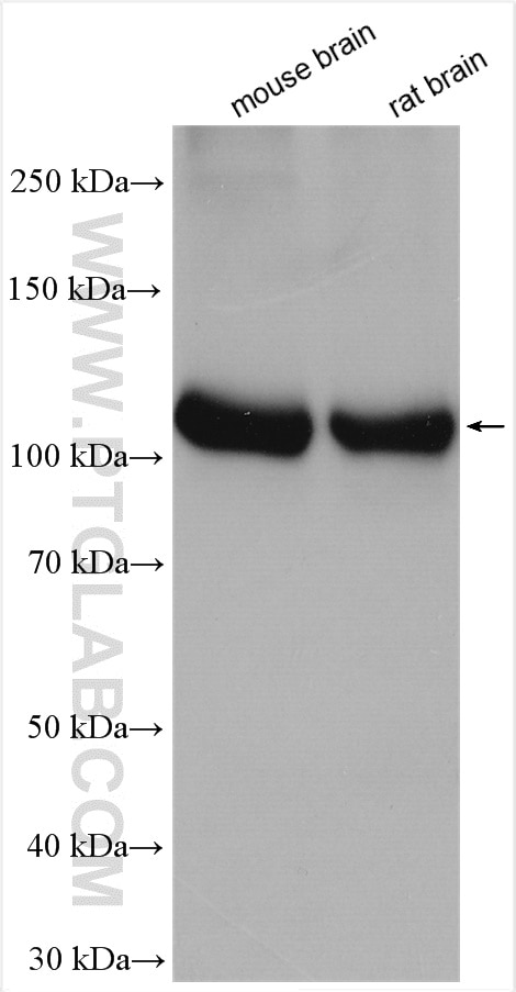Western Blot (WB) analysis of various lysates using ATP6V0A1 Polyclonal antibody (13828-1-AP)