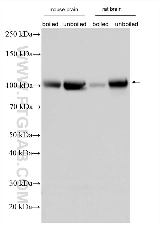 Western Blot (WB) analysis of various lysates using ATP6V0A1 Polyclonal antibody (13828-1-AP)