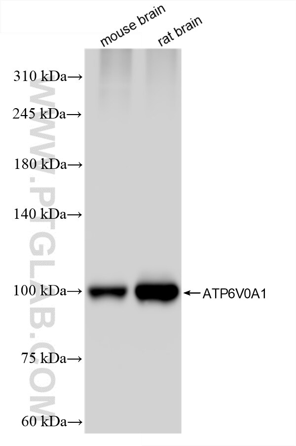 ATP6V0A1