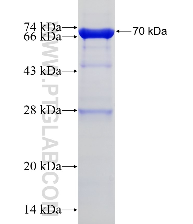 ATP6V0A1 fusion protein Ag4191 SDS-PAGE