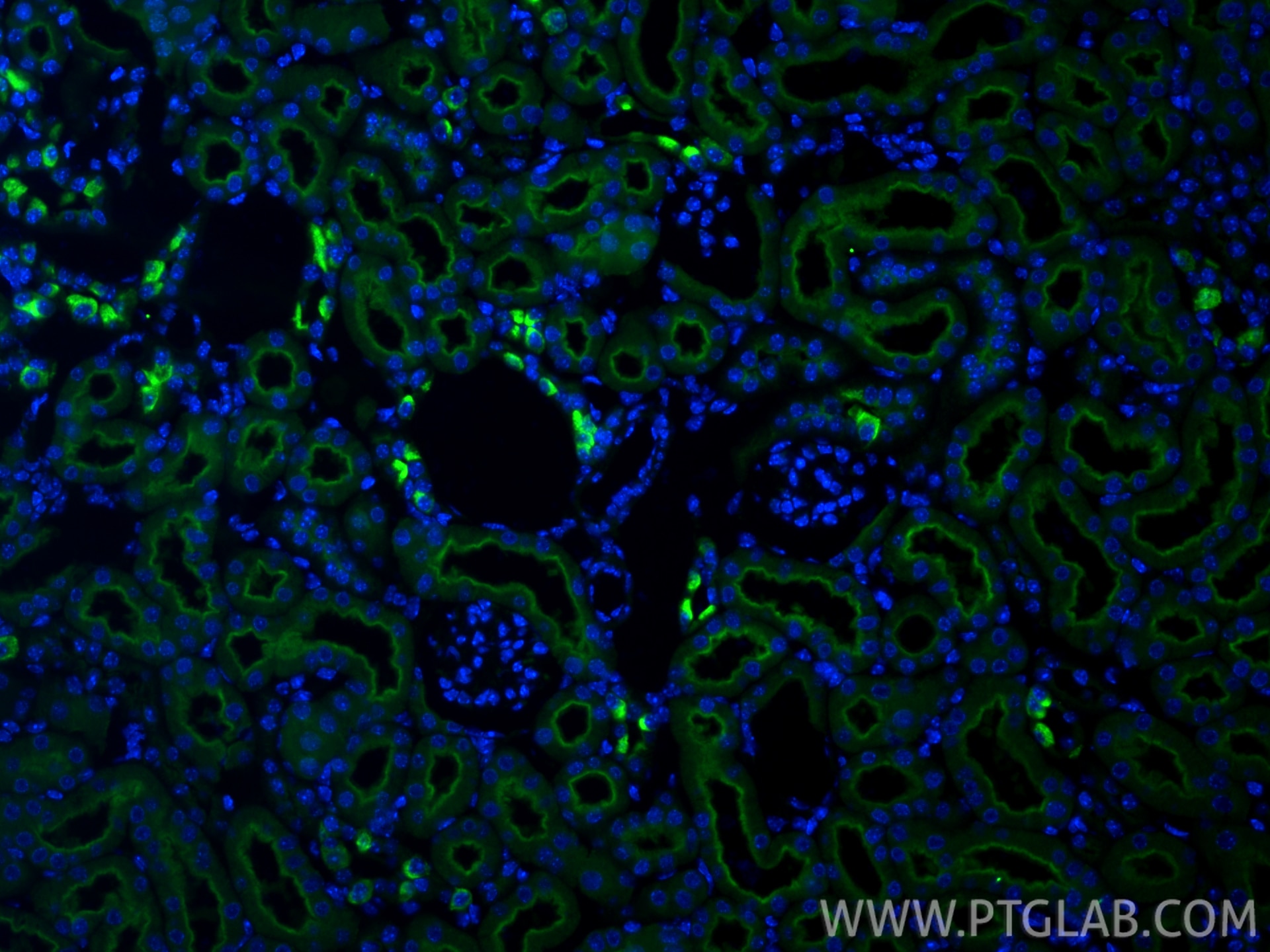 IF Staining of mouse kidney using 21570-1-AP Immunofluorescence (IF) / fluorescent staining of mouse kidney tissue using ATP6V0A4 Polyclonal antibody (21570-1-AP)