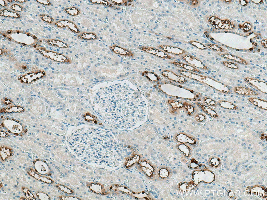 Immunohistochemistry (IHC) staining of human kidney tissue using ATP6V0A4 Polyclonal antibody (21570-1-AP)
